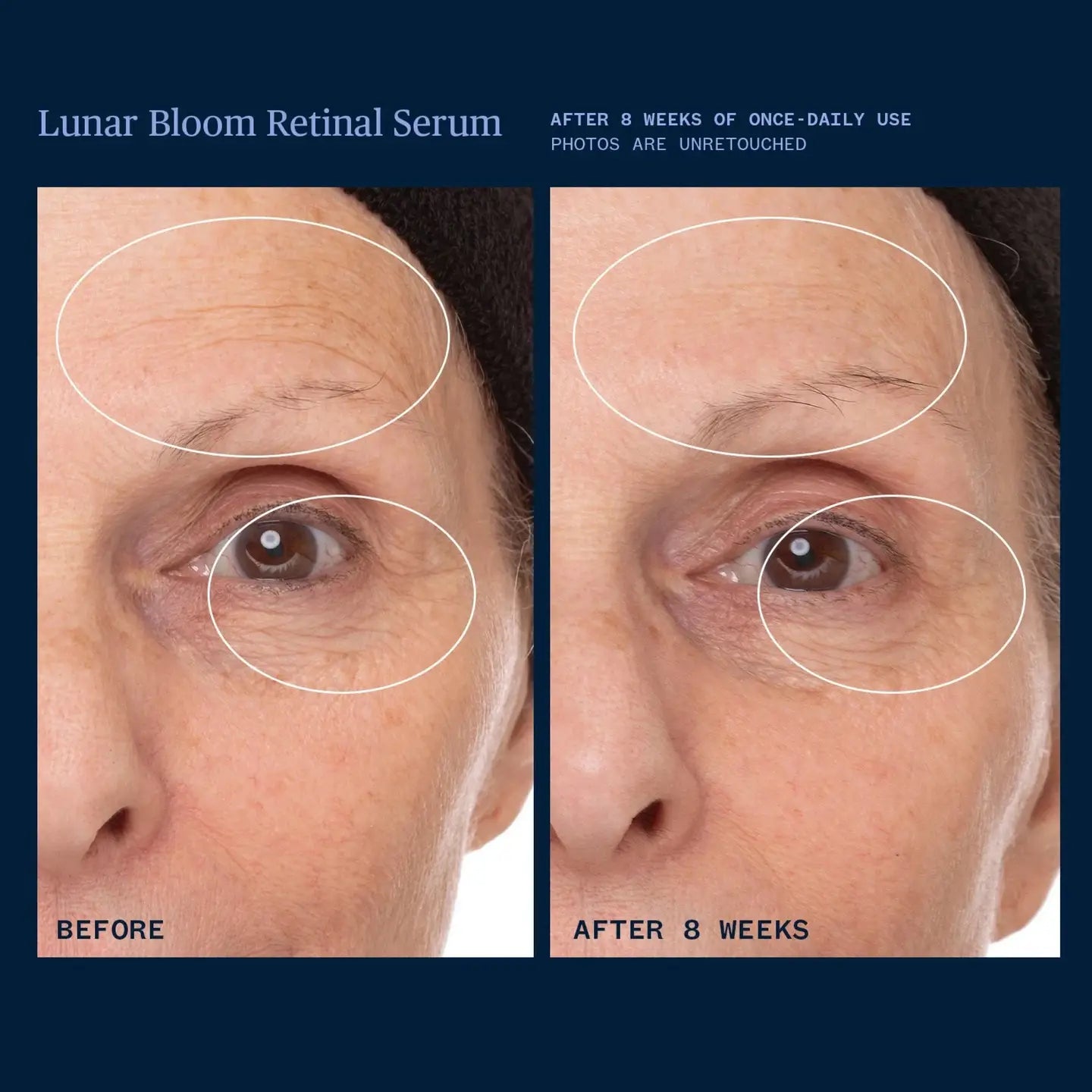 Lunar Bloom Retinal Serum
