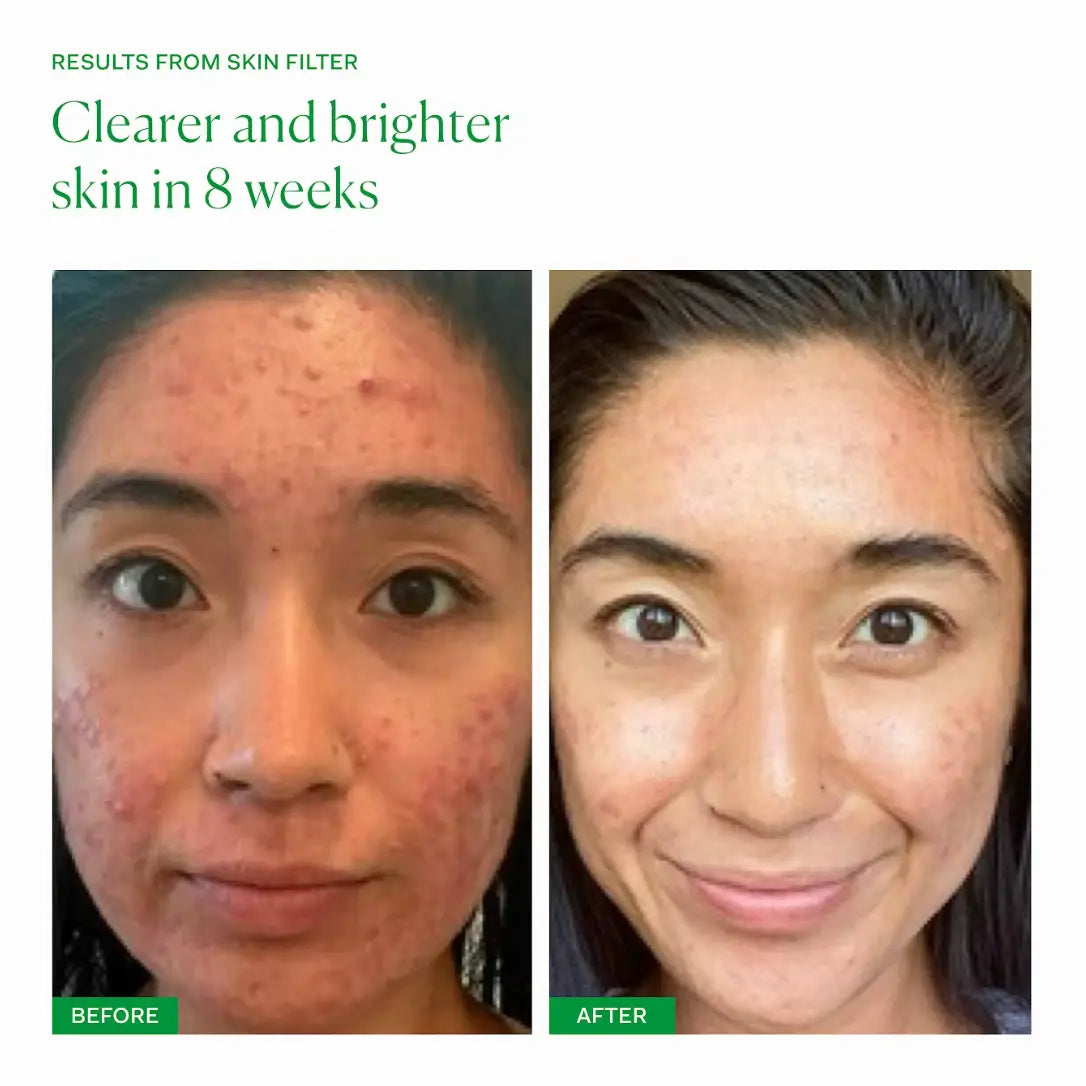 SKIN FILTER NUE supplement